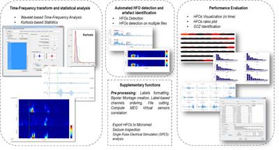 EPINETLAB: A Software for Seizure-Onset Zone Identification From Intracranial EEG Signal in Epilepsy